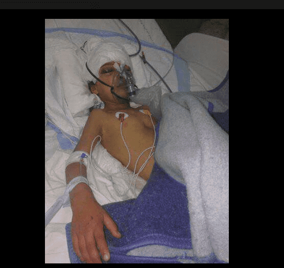 الطفلة فاطمة الزهراء بقسم العناية المركزة بمستشفى الفرابي بوجدة