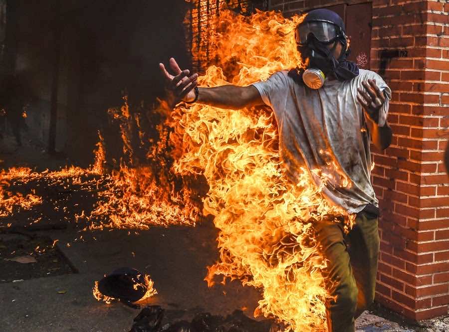 النار تشتعل بجسد أحد المتظاهرين بفنزويلا جراء انفجار خزان للغاز صورة: AFP