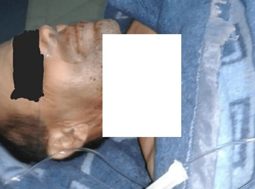 صورة الرجل الذي تعرض للذبح